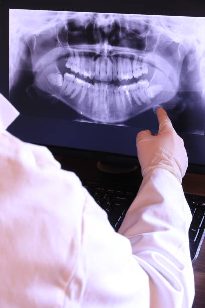 Best Emergency Tooth Extraction in Bethel Manor, VA